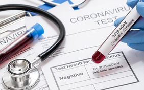 ordinanze coronavirus